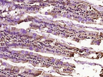 CCDC160 Polyclonal Antibody