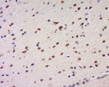 CCDC34 Polyclonal Antibody