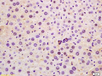 SRRM2 Polyclonal Antibody