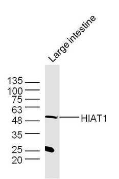 HIAT1 Polyclonal Antibody