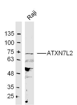 ATXN7L2 Polyclonal Antibody