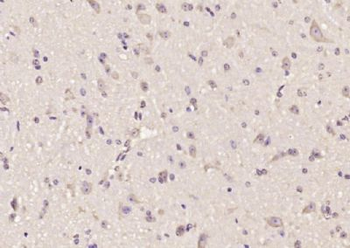 DAO1 Polyclonal Antibody