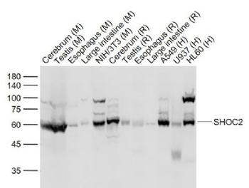 SHOC2 Polyclonal Antibody