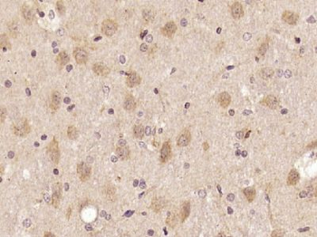 SIPA1L2 Polyclonal Antibody