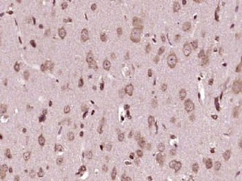 NEDD4 Polyclonal Antibody