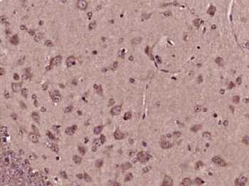CEND1 Polyclonal Antibody