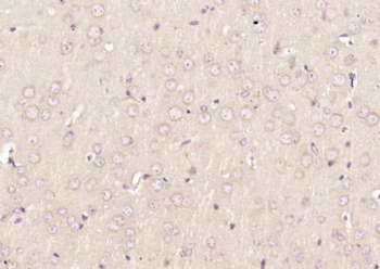 KNTC1 Polyclonal Antibody