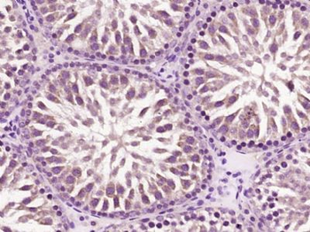 CCDC11 Polyclonal Antibody