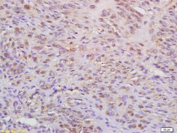 WAPL Polyclonal Antibody