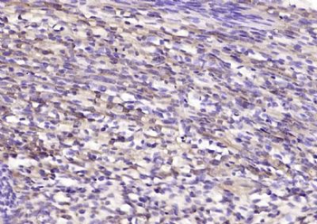 CAPD2 Polyclonal Antibody