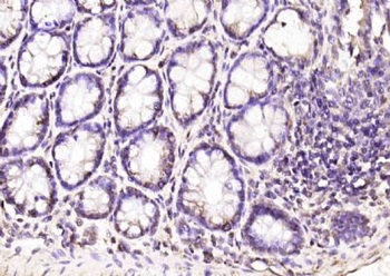 EAF2 Polyclonal Antibody