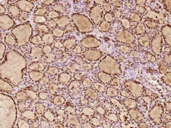 ZHX2 Polyclonal Antibody