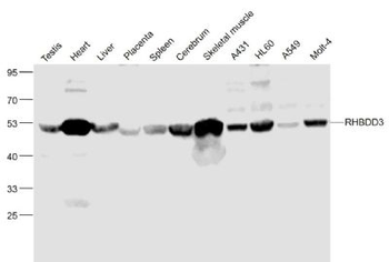 RHBDD3 Polyclonal Antibody