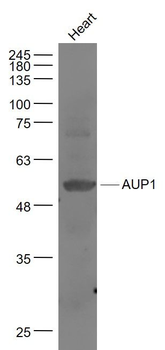 AUP1 Polyclonal Antibody