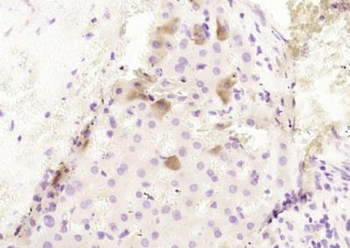 CPB2 Polyclonal Antibody