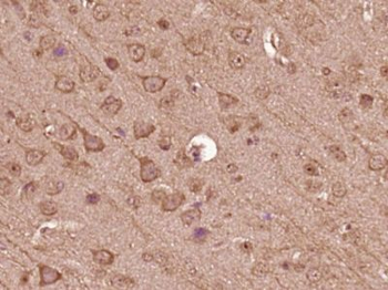 TBC1D15 Polyclonal Antibody
