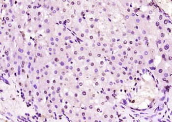 ZNF229 Polyclonal Antibody