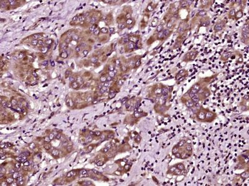 MAL2 Polyclonal Antibody