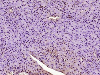 NUPR1 Polyclonal Antibody