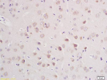 CLCN3 Polyclonal Antibody