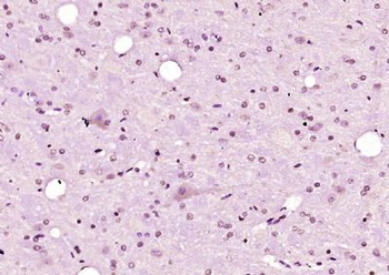CCDC17 Polyclonal Antibody