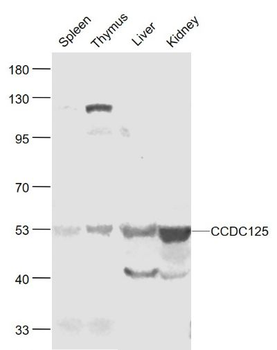 CCDC125 Polyclonal Antibody
