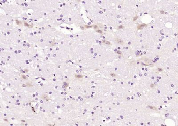 IFRD1 Polyclonal Antibody