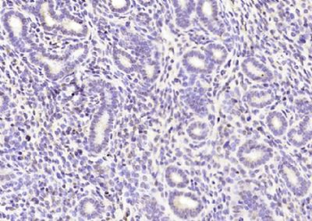 IFRD1 Polyclonal Antibody