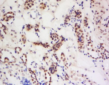 PIWIL4 Polyclonal Antibody