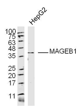 MAGEB1 Polyclonal Antibody