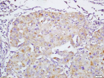 ANT-1 Polyclonal Antibody