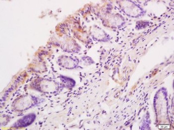 Sema3C Polyclonal Antibody