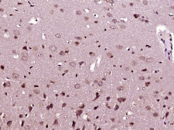 SCN8A/Nav1.6 Polyclonal Antibody