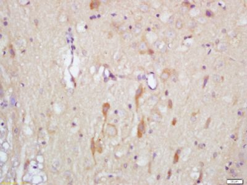 Slitrk1 Polyclonal Antibody