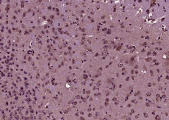 GDF10 Polyclonal Antibody