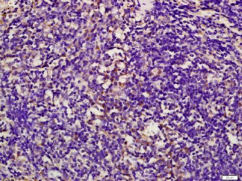 LZTFL1 Polyclonal Antibody