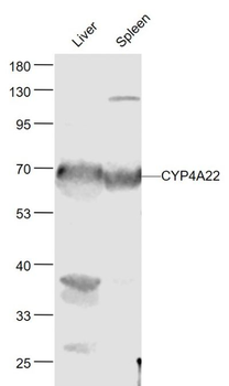 CYP4A22 Polyclonal Antibody