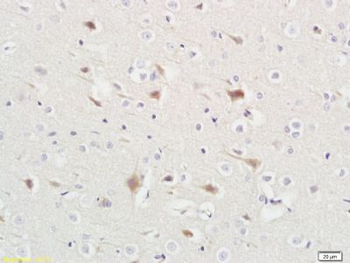 ABHD5 Polyclonal Antibody