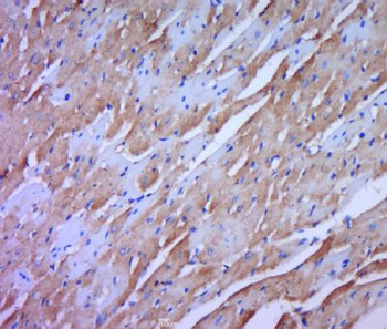 HOMER2 Polyclonal Antibody