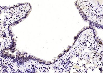 CUEDC2 Polyclonal Antibody