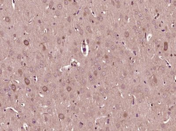 STRC Polyclonal Antibody