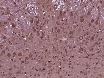 SCRG1 Polyclonal Antibody