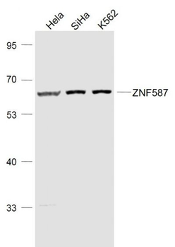 ZNF587 Polyclonal Antibody
