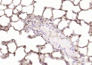 ZNF579 Polyclonal Antibody