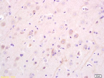 EBF3 Polyclonal Antibody