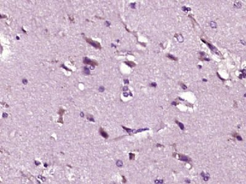 ARHGAP20 Polyclonal Antibody