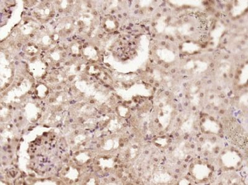 CDKN2B/p15 INK4b Polyclonal Antibody