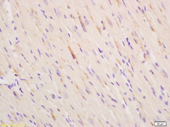 ITPR2 Polyclonal Antibody