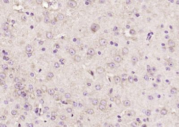 CHMP1A Polyclonal Antibody