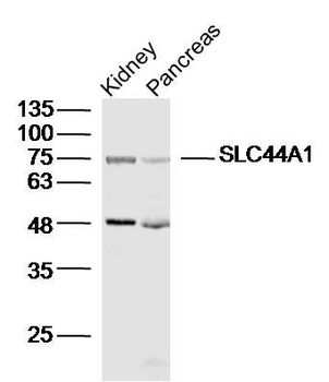 SLC44A1 Polyclonal Antibody